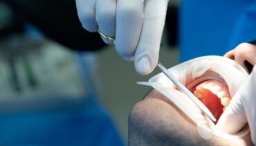 Χειρουργική Στόματος